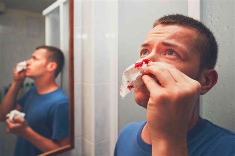 Bloody Nose Often