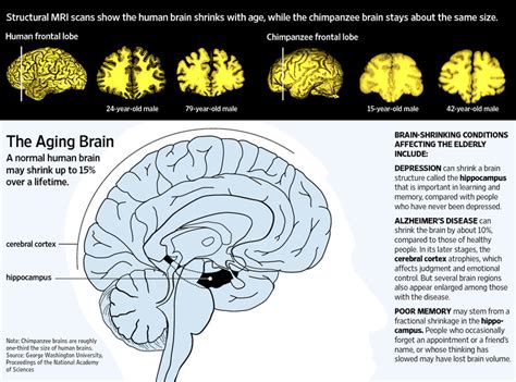 Brain Shrinks With Age