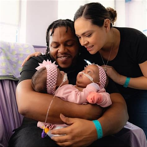 Conjoined Twins Triumph After Successful Separation At Four Months Conjoined Twins Triumph After Successful Separation At Four Months