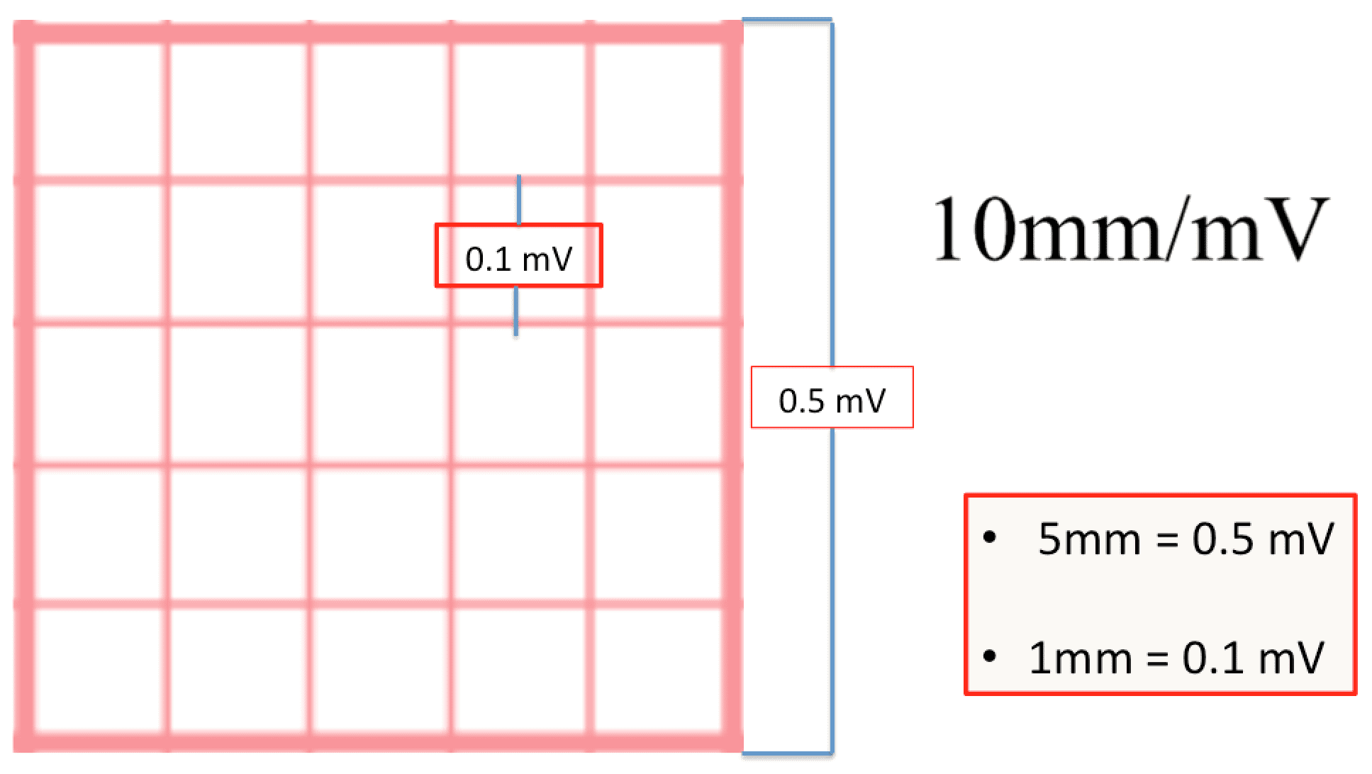 Ecg Voltage Ecg Voltage