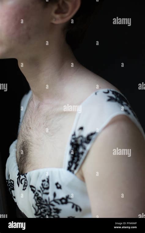 Female Chest Hair