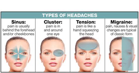 My Headache Hurts So Bad