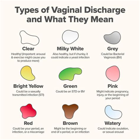 Normal Feminine Discharge