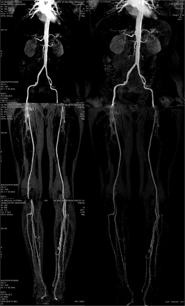 Pdf Value And Limitations Of Contrast Enhanced Mr Angiography In Pdf Value And Limitations Of Contrast Enhanced Mr Angiography In