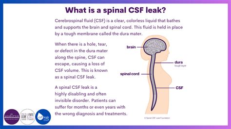 Spinal Fluid Leaking Into Brain