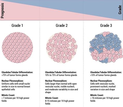 Staging Grade Breast Cancer Johns Hopkins Pathology Staging Grade Breast Cancer Johns Hopkins Pathology