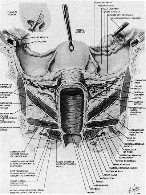 Vaginal Ridge