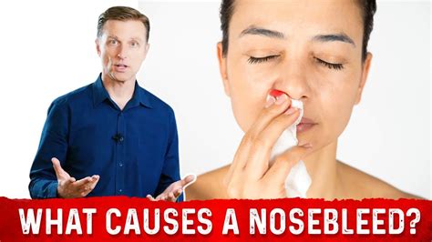 What Causes Nosebleeds Epistaxis 8 Common Causes Of Nose Bleeding What Causes Nosebleeds Epistaxis 8 Common Causes Of Nose Bleeding