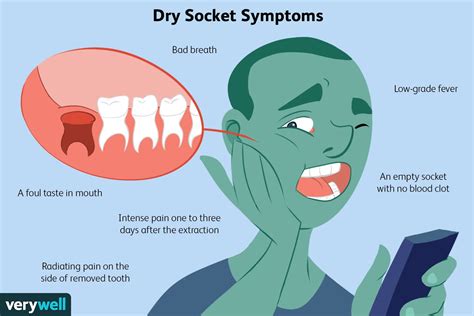 What Is Dry Socket